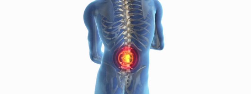 What is Ankylosing Spondylitis?