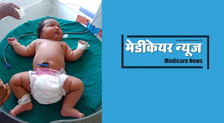 Indian woman delivers world’s heaviest baby in Karnataka