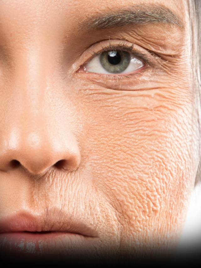 Surprising Ways To Reduce Wrinkles