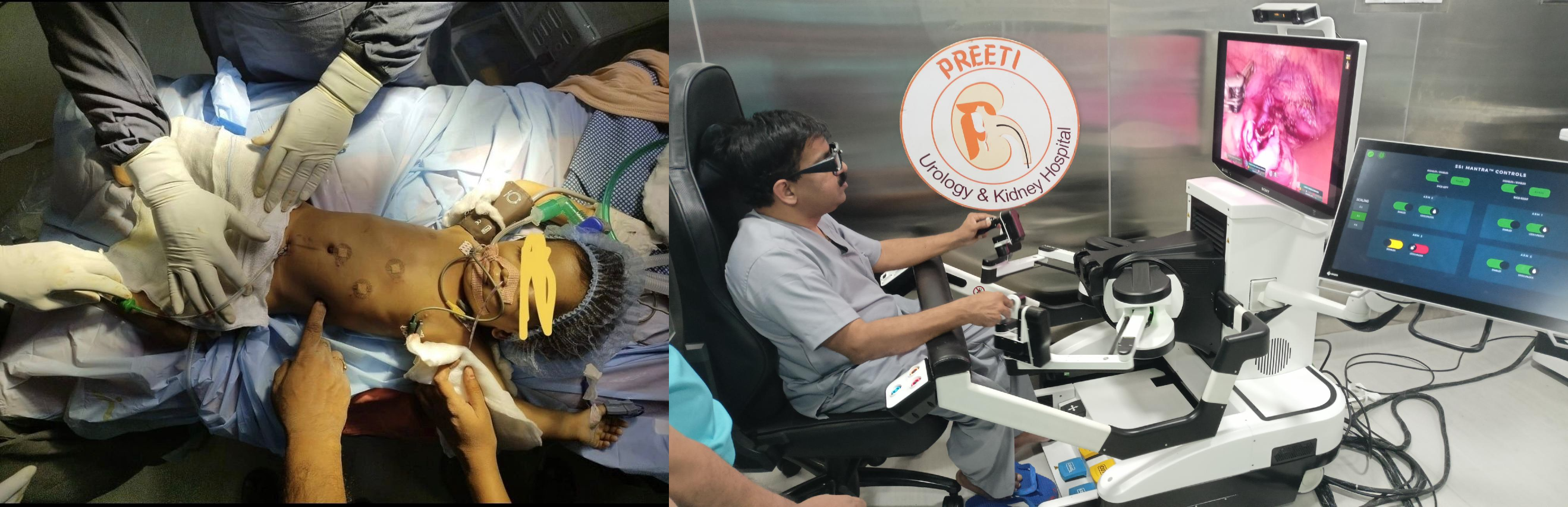 ‘Made in India’ Surgical Robot SSI Mantra takes giant baby step