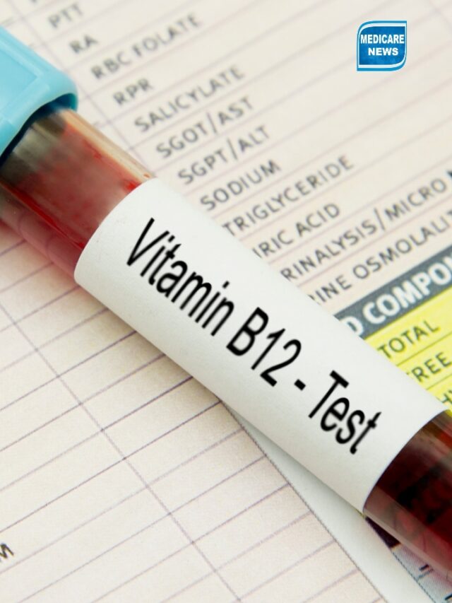 Vitamin B12 deficiency in women: 5 common signs