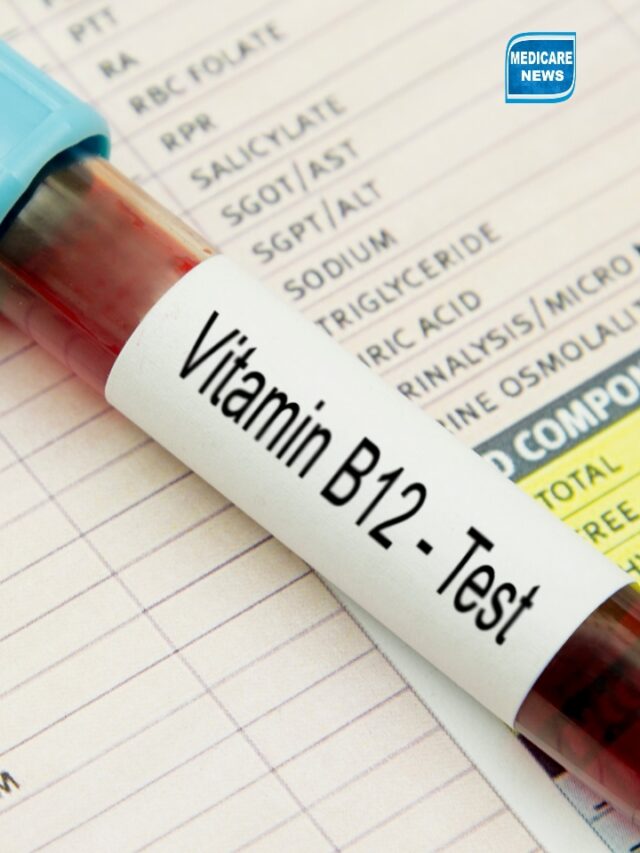 Vitamin B12 deficiency in women: 5 common signs