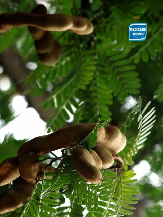 Tamarind: The Natural Weight Loss Wonder for Sustainable Wellness
