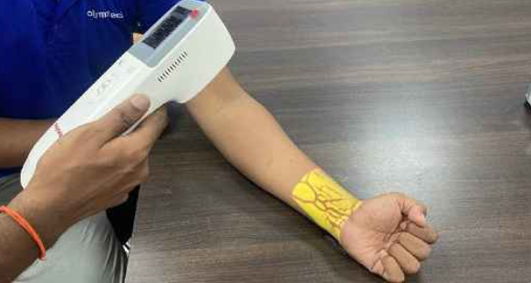 Polymatech begins domestic manufacturing of vein finder devices