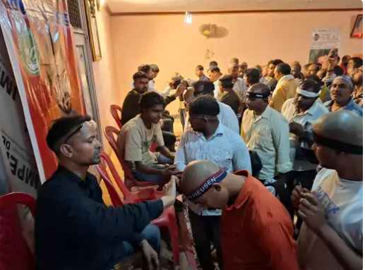 Officials’ Apathy Allows Quackery To Flourish: Delhi’s ‘Salman Bhai’ Runs Paid ‘Herbal Cure’ Camp For Incurable Alopecia In Mughalsarai