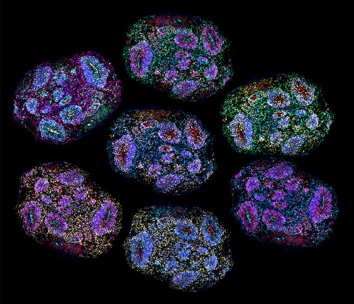 Brain organoid maturation is driven by a lifelike developmental clock: Study