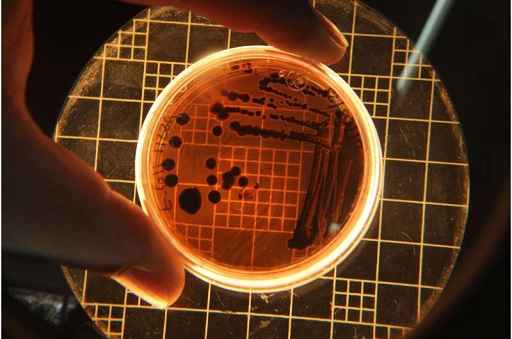 Second Documented Case of Pan-Drug Resistant Candida auris Uncovered in Kenya