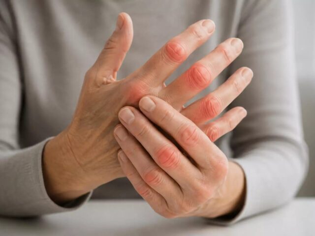 National Institute of Nutrition study finds strong link between diet quality and Rheumatoid Arthritis
